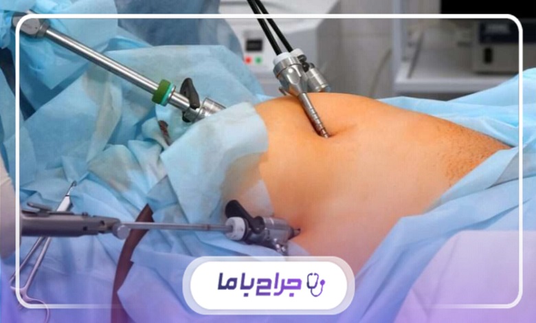 خدمات بهترین دکتر جراح ساکشن در تهران