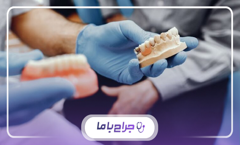 چه کسانی کاندید مناسبی برای ایمپلنت فوری نیستند؟