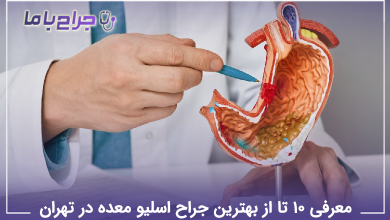 بهترین جراح اسلیو معده در تهران
