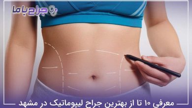 بهترین جراح لیپوماتیک در مشهد