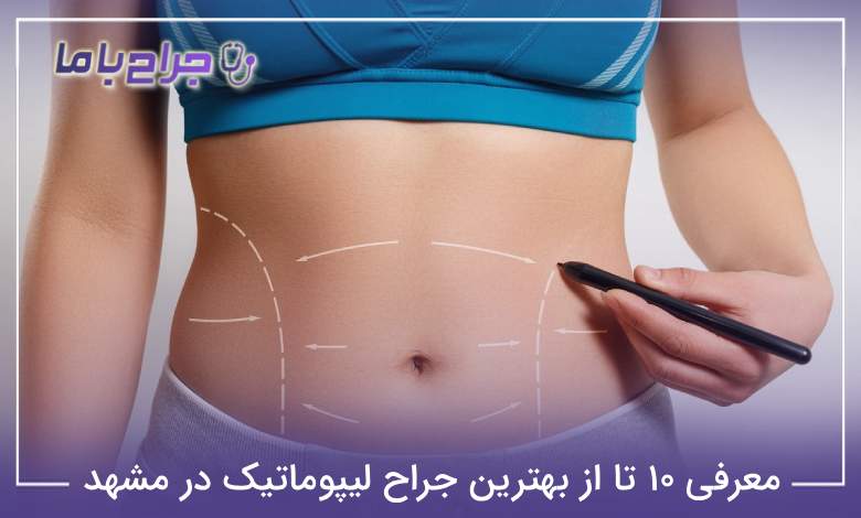 بهترین جراح لیپوماتیک در مشهد