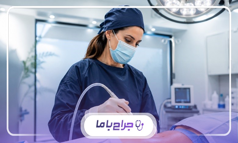 جراحی لیپوماتیک مناسب چه افرادی است؟