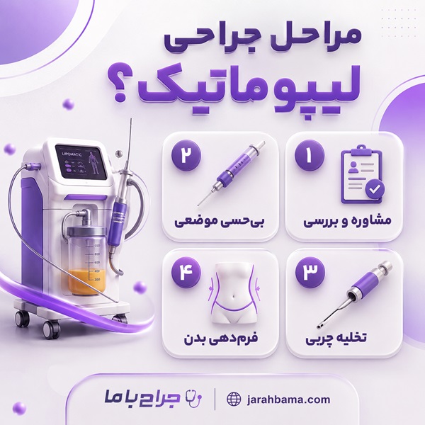 چگونه بهترین جراح لیپوماتیک در مشهد را انتخاب کنیم؟