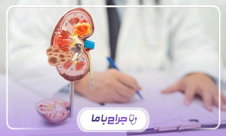 روشهای درمانی بهترین دکتر اورولوژی در مشهد