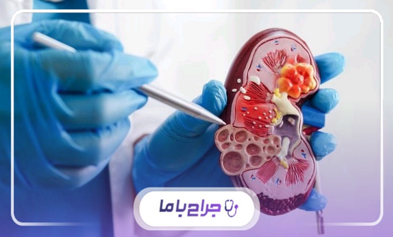 چه کسانی باید به متخصص اورولوژی مراجعه کنند؟