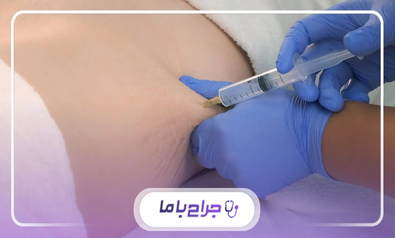 چگونه پزشک فیلر بادی مناسب را در پرند انتخاب کنیم؟