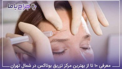 بهترین مرکز تزریق بوتاکس در شمال تهران