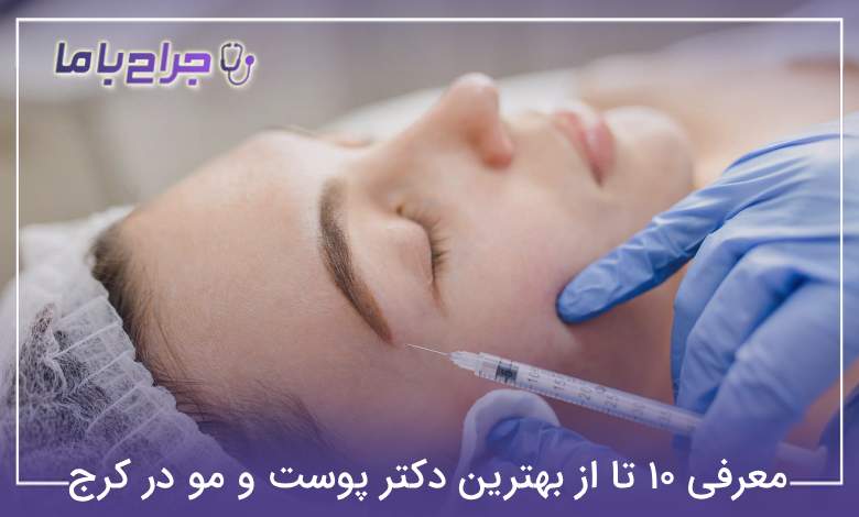 بهترین دکتر پوست و مو در کرج