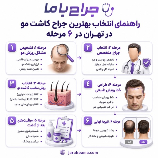 بهترین جراح کاشت مو در تهران را چگونه انتخاب کنیم؟