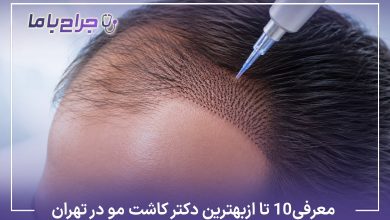 معرفی 10 تا از بهترین دکتر کاشت مو در تهران【سال1405】⚡