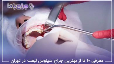 بهترین جراح سینوس لیفت در تهران