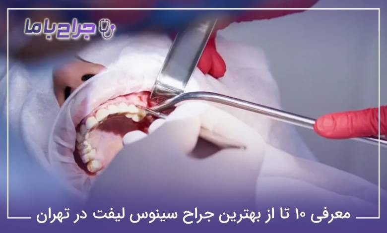 بهترین جراح سینوس لیفت در تهران