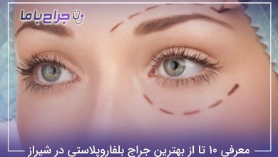 بهترین جراح بلفاروپلاستی در شیراز