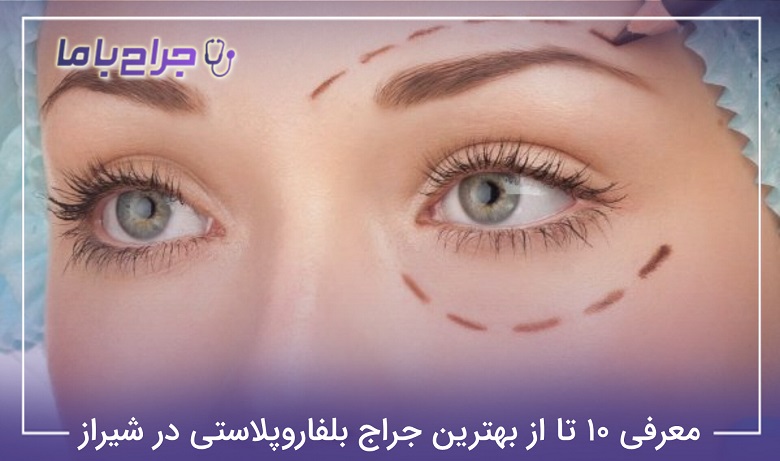 بهترین جراح بلفاروپلاستی در شیراز
