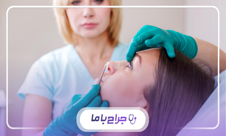 مدیریت دوران نقاهت و مراقبتهای حیاتی پس از رینوپلاستی