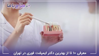 بهترین دکتر ایمپلنت فوری در تهران