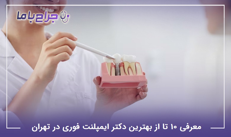 بهترین دکتر ایمپلنت فوری در تهران