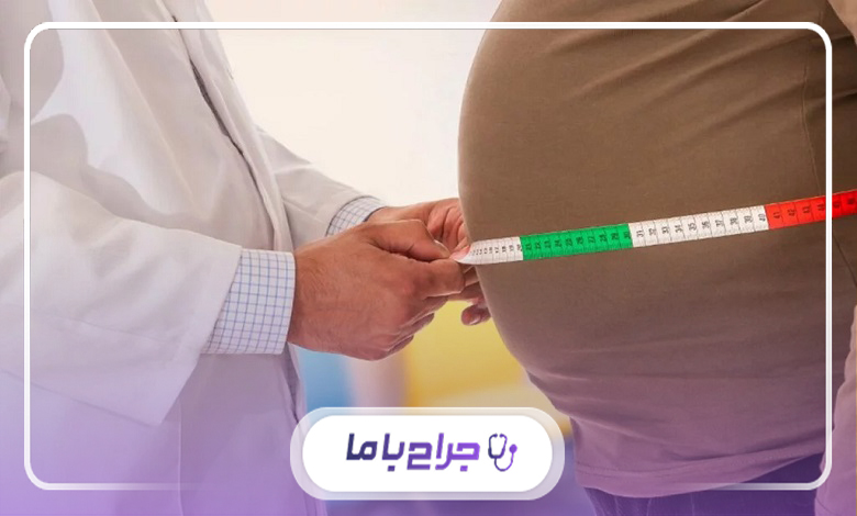 هزینه جراحی عمل اسلیو معده در شهر کرج