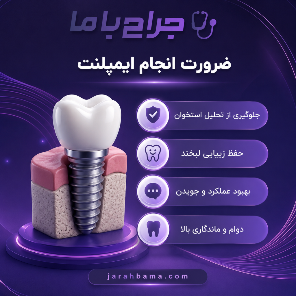 بهترین متخصص ایمپلنت اصفهان؛ مقایسه برندها، تکنولوژی و قیمتها