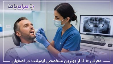 بهترین متخصص ایمپلنت در اصفهان