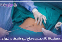 معرفی 10 تا از بهترین جراح لیپوماتیک در تهران