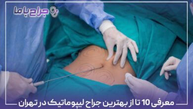 معرفی 10 تا از بهترین جراح لیپوماتیک در تهران