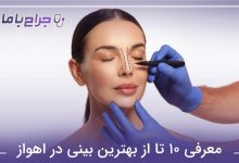 بهترین جراح بینی در اهواز