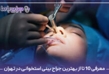 معرفی 10 تا از بهترین جراح بینی استخوانی در تهران