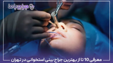 معرفی 10 تا از بهترین جراح بینی استخوانی در تهران