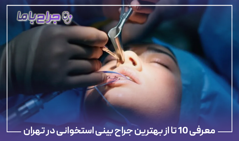 معرفی 10 تا از بهترین جراح بینی استخوانی در تهران