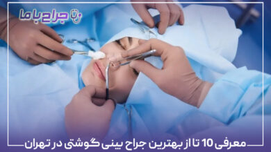 معرفی 10 تا از بهترین جراح بینی گوشتی در تهران