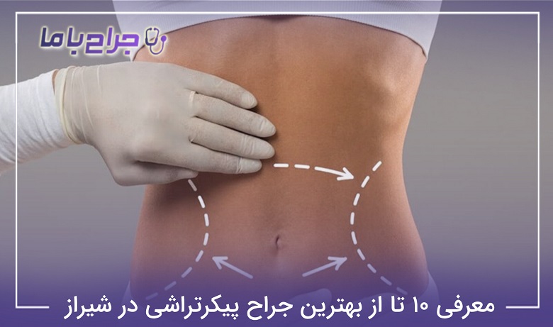 بهترین جراح پیکرتراشی در شیراز