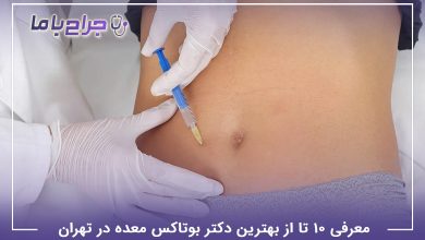 بهترین دکتر بوتاکس معده در تهران