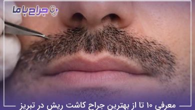 بهترین جراح کاشت ریش در تبریز
