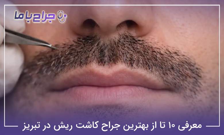 بهترین جراح کاشت ریش در تبریز
