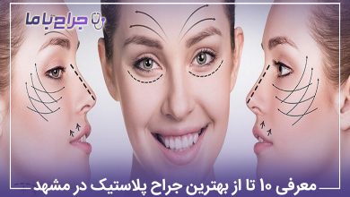 معرفی10 تا از بهترین جراح پلاستیک در مشهد【آپدیت1405】⚡