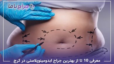 بهترین جراح ابدومینوپلاستی در کرج