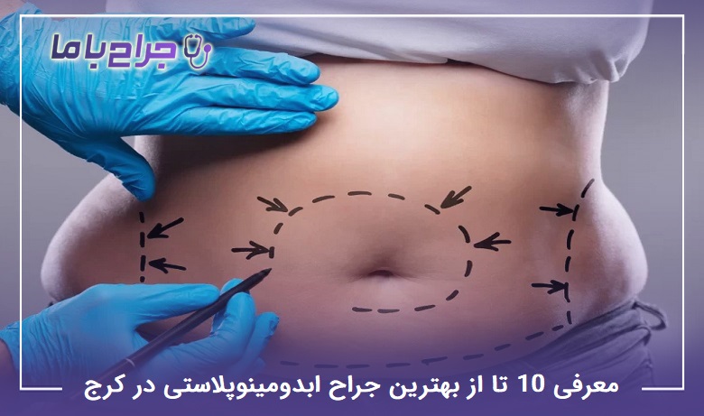 بهترین جراح ابدومینوپلاستی در کرج