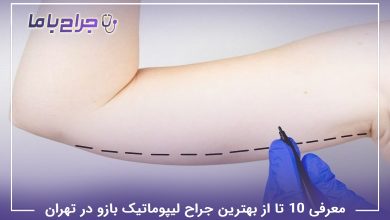 بهترین دکتر لیپوماتیک بازو در تهران