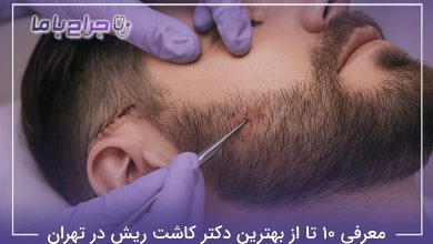 بهترین دکتر کاشت ریش در تهران