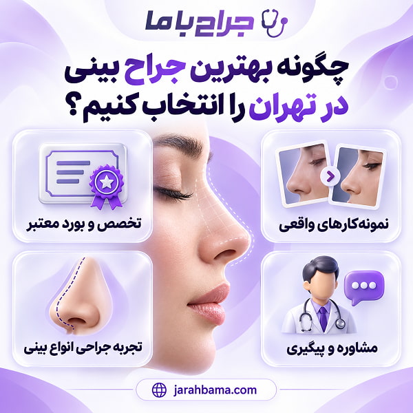 مهم ترین معیارهای انتخاب بهترین جراح بینی تهران