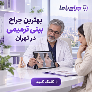 مهم ترین معیارهای انتخاب بهترین جراح بینی تهران