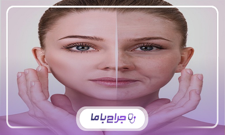 ضرورت مراجعه به بهترین مراکز جوانسازی صورت در شهریار