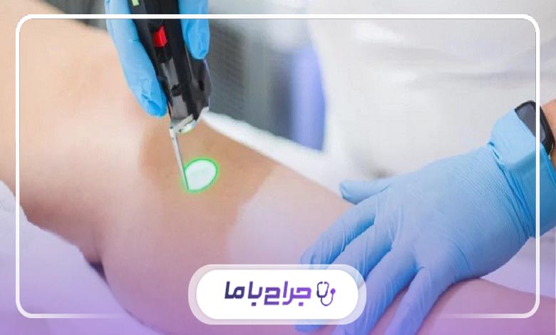 اهمیت مراجعه به بهترین کلینیک لیزر موهای زائد در اندیشه