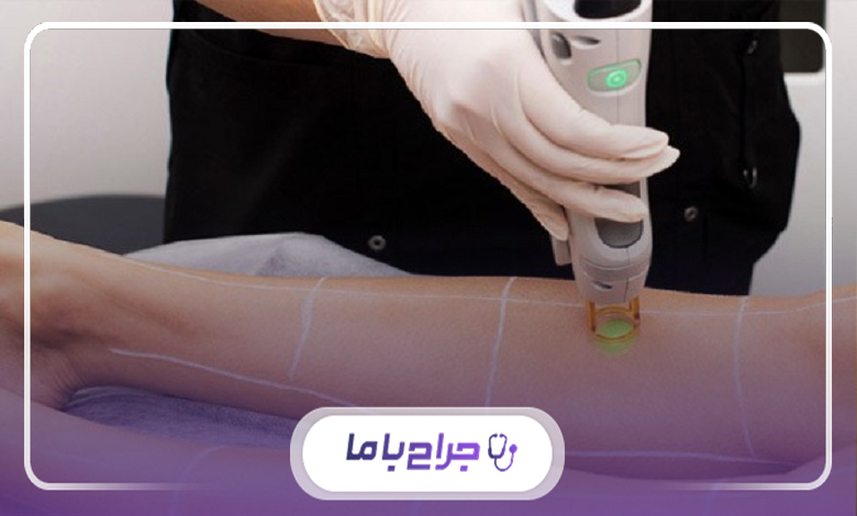 ضرورت مراجعه به بهترین مرکز لیزر فول بادی در اندیشه