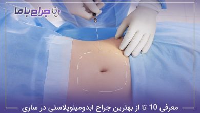 بهترین جراح ابدومینوپلاستی در ساری