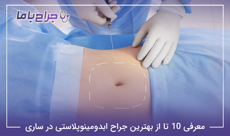 بهترین جراح ابدومینوپلاستی در ساری