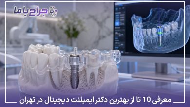 معرفی۱۰ تا از بهترین دکتر ایمپلنت دیجیتال در تهران❤️【آپدیت1405】