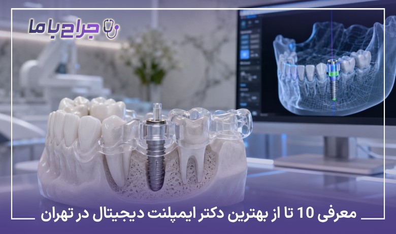 معرفی۱۰ تا از بهترین دکتر ایمپلنت دیجیتال در تهران❤️【آپدیت1405】