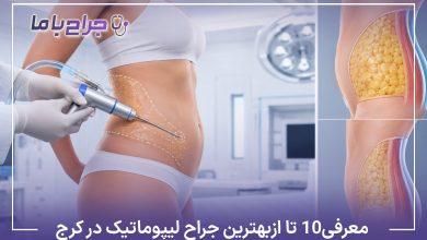معرفی10 تا از بهترین جراح لیپوماتیک در کرج【سال1405】❤